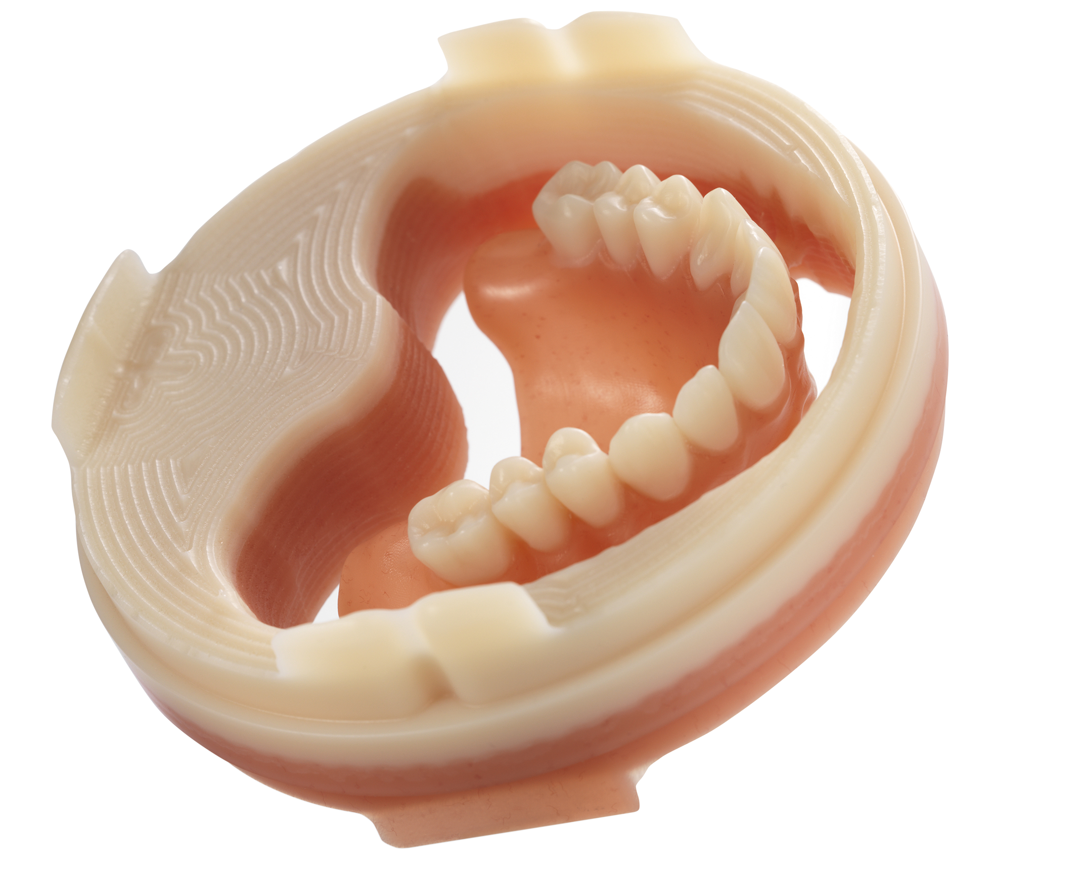 Dyna Dental Digitale Prothese